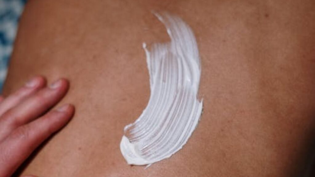 crema Nirvedol aplicada en la zona lumbar